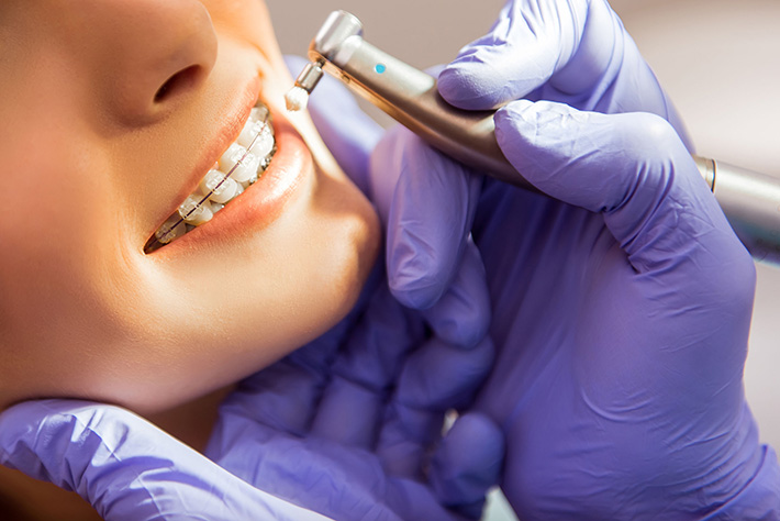 Is Cosmetic Dentistry A Reliable Option